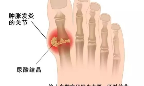 黄蜀葵花泡水喝治疗蛋白尿吗-黄蜀葵花的产地及药用网黄蜀葵花的图片知识网站,分享黄蜀葵花图片大全大全